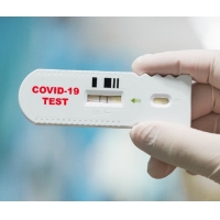 Rapid tests for the detection of SARS-CoV-2 antigen
